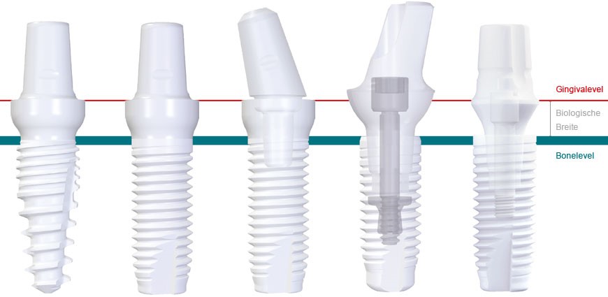 Keramikimplantate Z-Systems