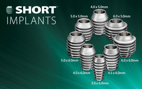 Kurze Implantate - Short implants